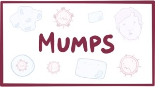 Mumps  symptoms diagnosis treatment pathology [upl. by Anzovin999]