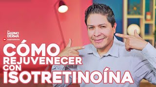 COMO REJUVENECER TU PIEL CON ISOTRETINOINA [upl. by Liam]