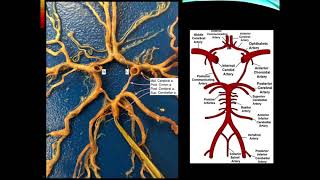 Stroke  Cerebrovascular Accident CVA [upl. by Witt479]