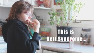 Typical Rett Syndrome Hand Wringing [upl. by Erreid]