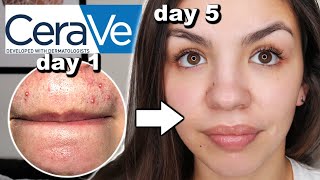 I Used CeraVe Skincare For One Week [upl. by Cassil154]