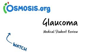 Glaucoma  Clinical Presentation [upl. by Chitkara]