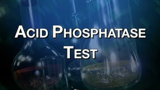 Acid Phosphatase Test [upl. by Georg]