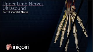 ULNAR NERVE ULTRASOUND [upl. by Harwill]