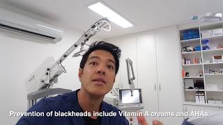 BLACKHEADS IN EARS [upl. by Adni]