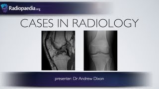 Cases in Radiology Episode 4 musculoskeletal MRI xray [upl. by Adiaros305]