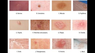 Skin Lesions with defination [upl. by Jenness]