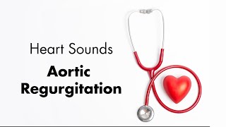 Aortic Regurgitation  Heart Sounds  MEDZCOOL [upl. by Elehcar]