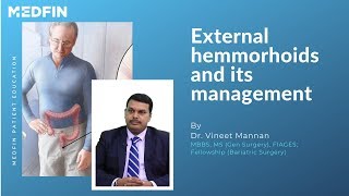 What are external hemorrhoids [upl. by Ohara]