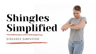 Shingles Simplified [upl. by Atiuqrahc]