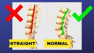 Exercises for sciatica spinal stenosis  NHS [upl. by Eldin]