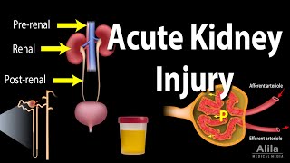 Acute Kidney Injury aka Acute Renal Failure Animation [upl. by Anissa23]