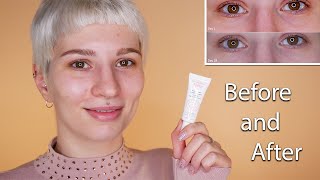 Avene Soothing Eye Contour Cream  Before amp After [upl. by Lorelei]