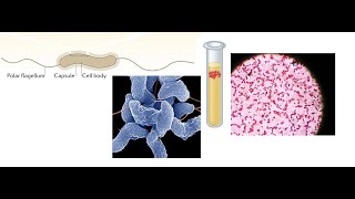 Acute GI Campylobacter and Salmonella [upl. by Ymor]