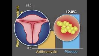 PostCesarean Infection and Antibiotic Prophylaxis  NEJM [upl. by Papst]