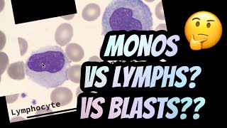 How I distinguish between Lymphocytes vs Monocytes [upl. by Ninerb775]