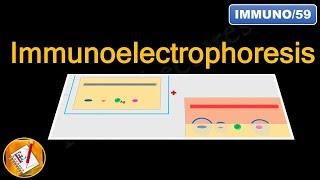 Immunoelectrophoresis FLImmuno59 [upl. by Snashall]