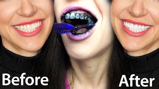 Fastest Way To Whiten Teeth At Home What REALLY Works [upl. by Urbai65]