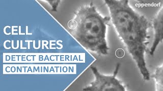 CONTAMINACIÓN DEL SUELO  Causas consecuencias y SOLUCIONES [upl. by Docile405]