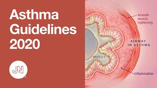 Asthma Guidelines Update 2020  Diagnosis and Management [upl. by Keligot]