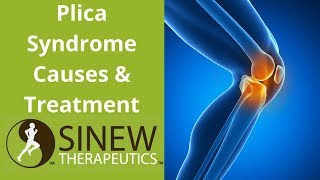 Plica Syndrome Causes and Treatment [upl. by Ragde]